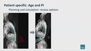 Revision Lumbar Sagittal Realignment: Tips and Pearls