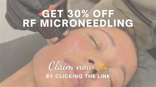 REDLANDS & SURROUNDING AREAS! 💖 From wrinkles & scars and everything in between, Radiofrequency (RF) Microneedling treatments can tighten, tone, and help with a wide variety of skin concerns! Best part? For a limited time, we're offering 30% OFF RF Microneedling! (Includes both face and neck) 😱 👉 https://www.special-hushhmedicalaesthetics.com/30-rfmicroneedling RF Microneedling can help with… ✅ Wrinkles ✅ Large pores ✅ Various scars ✅ Sagging skin ✅ And more! 🕐 Quick 30 min treatment 📆 Litt