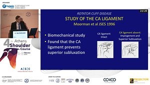 Anterior or Lateral Acromioplasty: Is It Always Necessary?