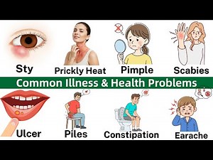 Common Illnesses and Health Problems Vocabulary in English | Disease Names | Vocabulary
