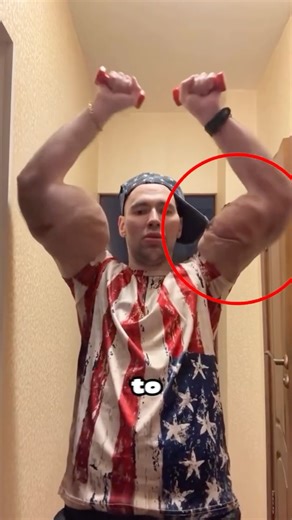 His Arm Might Get Amputated🤯😱(@bazookahands)