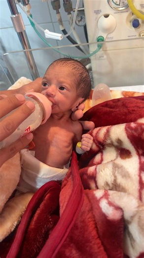 Abdominal Pain in Baby | Signs & Gentle NICU Care 🩺