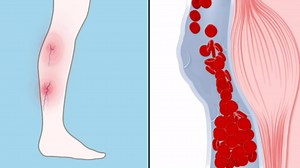 Juzo Soft 2002, Thigh-High, 30-40 mmHg, Open Toe Compression Stocking with Silicone Top Band - Men & Women, Regular, 3 (III), Black