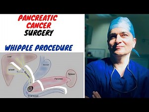 UNDERSTANDING WHIPPLE PROCEDURE