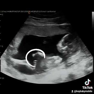 Gender Reveal Ultrasound Explained at 14 Weeks 6 Days Pregnant