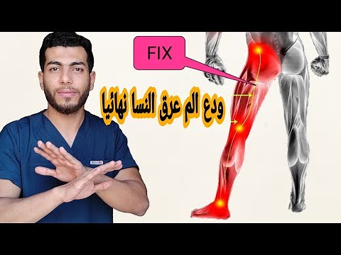 Say goodbye to sciatica for good after watching this video | Causes, symptoms, and the latest tre...