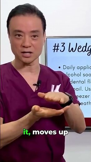 Stop Ingrown Nail Pain FAST with Cotton Pads! #shorts #ingrownnails #shortsyoutube