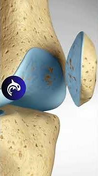 Front Knee Pain? Learn about Runner's Knee - Patellofemoral Pain Syndrome