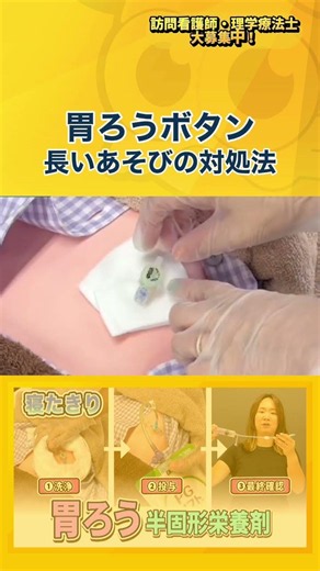 【胃ろう】長いあそびの対処法【訪問看護】