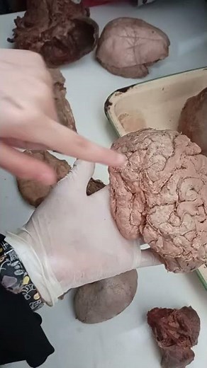 Sulci and Gyri of brain