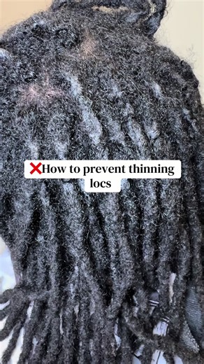 Essential Tips for Healthy Locs Care