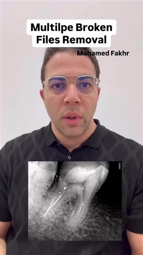 Effective Clinical Tips for Dental File Management