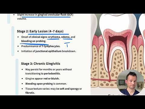 Perio 2 | RDH blueprint board exam Prep