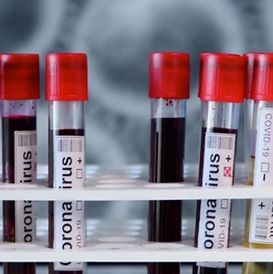 The U.S. is considering “pooled” #covid19 testing. Here’s what that means. | Dr. Mehmet Oz