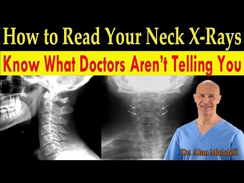 How to Read Your Neck X-rays / Know What Doctors Are Not Telling You - Dr. Alan Mandell, D.C.