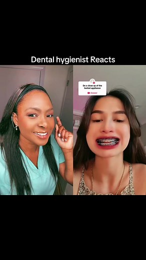 Zaira Monzon Braces and Jaw Correction: Fixing Uneven Jawline