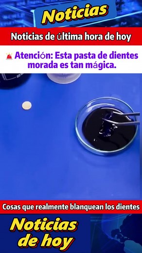 Elige la pasta de dientes adecuada para limpiar tus dientes#pastadental #cuidadodental #cariesdental #dientesfijos