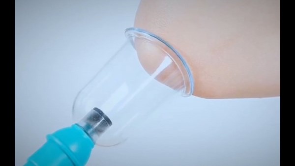 Watch Massage Cupping Set Chinese Medical Cupping Sets on Amazon Live