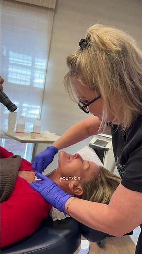 5 Reasons to Love TCA Peels