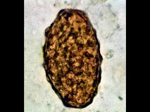 Roundworm or Ascaris lumbicoides egg under the microscope in saline preparation
