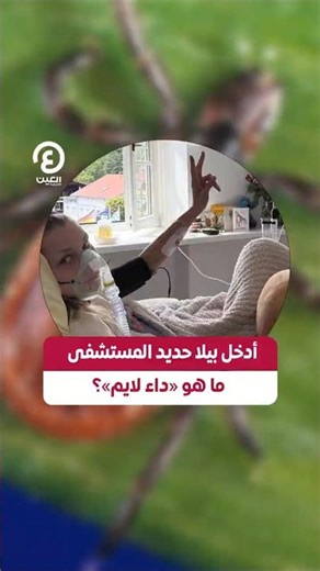 #shorts | أدخل بيلا حديد المستشفى .. ما هو «داء لايم»؟
