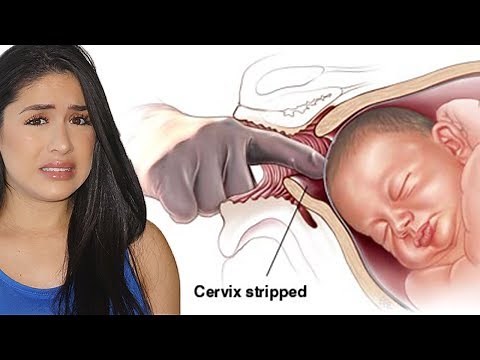 MY MEMBRANE SWEEP | Did it work?