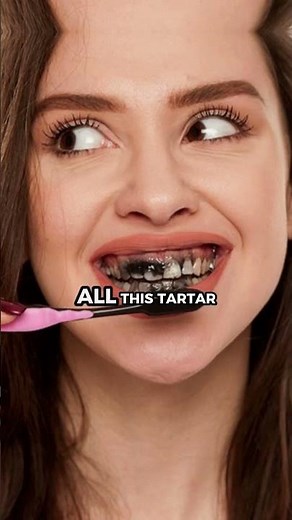 Before You Use Charcoal Toothpaste 😳 Watch This First