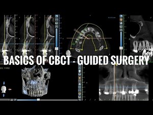 Basics Of CBCT - Guided Surgery Part 1