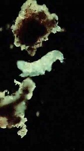 Exploring Pond Water Under the Microscope