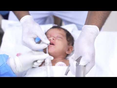 Cleft Lip Baby Going into Anesthesia