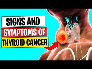 7 Signs & Symptoms of THYROID CANCER You Shouldn't Ignore