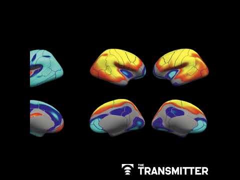 Poor image quality introduces systematic bias into large neuroimaging datasets