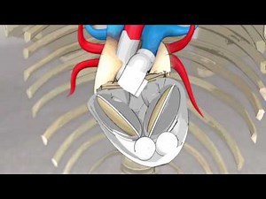 Ever wondered how an artificial heart works? Watch this