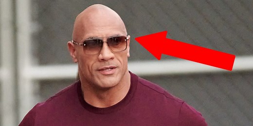 A dermatologist explains why some men lose their hair