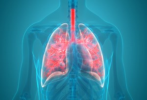 Laryngotracheal Stenosis