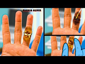 [ASMR ANIMATION] Removing The ring got stuck and infected In Hand /Worm Removal and Pus Removal