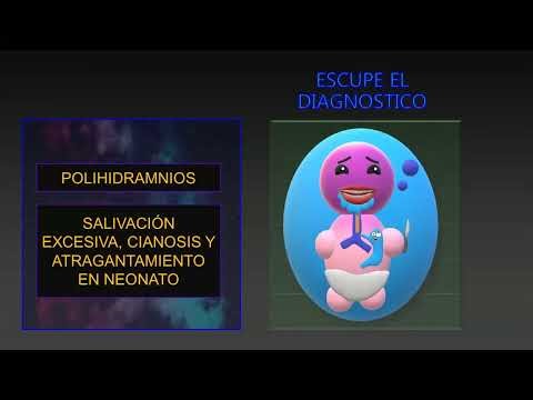 Mega-repaso PEDIATRÍA (ENARM 2022)