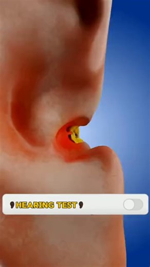 Struggling to hear clearly? 🦻 Try an online hearing test today! Early detection is key. Take the first step toward better hearing today. | Health Insights