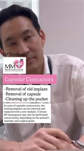 Capsular Contracture Correction Yes, with capsular contracture, the...