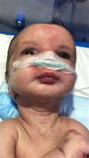 CP Child #newbornbaby