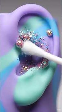 You Won’t Believe What Came Out | Deep Ear Cleaning (So Satisfying!)