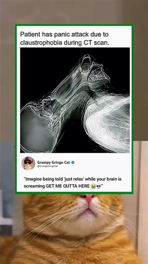 when they say just relax during a panic attack 😭 | funny memes | dank memes | viral memes