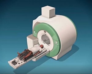 TULSA PRO - Profound Medical