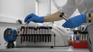 Medical Equipment Test Examination Centrifuge Research Stock Footage Video (100% Royalty-free) 1010955578 | Shutterstock