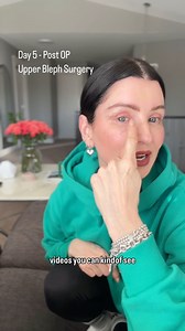 27K views · 194 reactions | Day 5 - March 11, 2025 Upper Bleph...