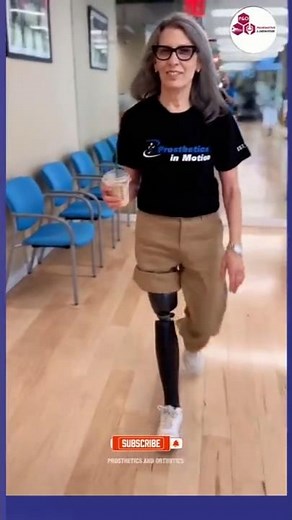 Strong Woman Above Knee Amputation | Artificial Limb Walking with Confidence & Smile