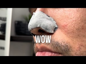 #Skincare #blackhead pore strip on the nose that turned out to be a lot. #ASMR