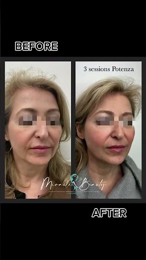 🌟 Before and After with Potenza! 🌟
