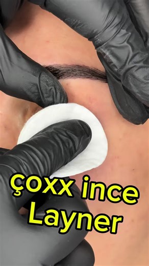 Layner Proseduru ilə Qalıcı Göz Süsü