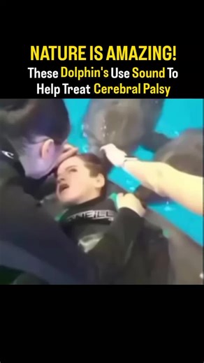 Can Dolphins Heal with Sound? 🐬🔊 | The Truth Behind Echolocation & Therapy A viral video shows dolphins surrounding a young boy with cerebral palsy, emitting rapid clicking sounds—often described as “treatment”. It’s a powerful and emotional moment… but what does science actually say? 🧠 Dolphins use a biological sonar system known as echolocation. They produce high-frequency clicks (often between 40 kHz and 150 kHz) which travel through water, bounce off objects, and return as echoes. These s